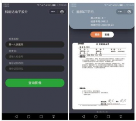醫(yī)用電子膠片軟件med electronic film廠家